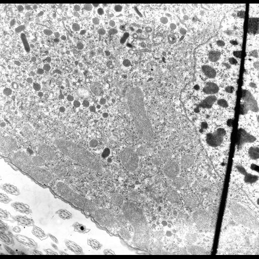  NCBI Organism:uncultured Scuticociliatia, , ; Cell Types:cell by organism, eukaryotic cell, , ; Cell Components:macronucleus, cytoplasm, mitochondrion, mitochondrial crista, mitochondrial envelope, peroxisome, endosome; Biological process:macronucleus organization, mitochondrion organization, cytoplasm organization, endosome localization;