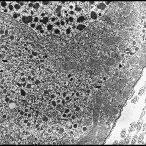  NCBI Organism:uncultured Scuticociliatia, , ; Cell Types:cell by organism, eukaryotic cell, , ; Cell Components:macronucleus, mitochondrial crista, cytoplasm, endosome, cell cortex, nuclear membrane, nuclear outer membrane-endoplasmic reticulum membrane network; Biological process:cortical cytoskeleton organization, macronucleus organization, mitochondrion organization, mitochondrial membrane organization, endosome organization;