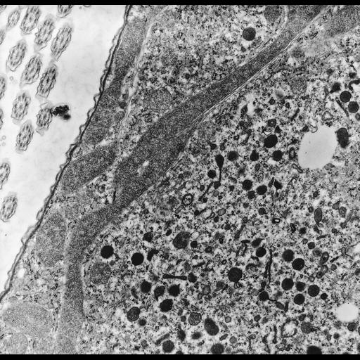  NCBI Organism:uncultured Scuticociliatia, , ; Cell Types:cell by organism, eukaryotic cell, , ; Cell Components:plasma membrane, cell cortex, mitochondrion, mitochondrial crista, cytoplasm, endosome; Biological process:cytoplasm organization, mitochondrion organization, cortical cytoskeleton organization, endosome organization;