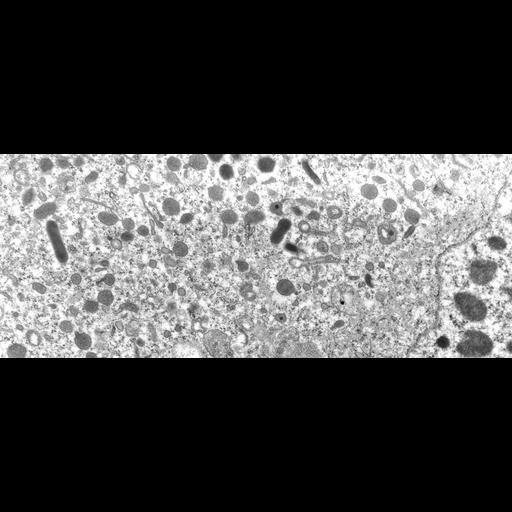  NCBI Organism:uncultured Scuticociliatia, , ; Cell Types:cell by organism, eukaryotic cell, , ; Cell Components:macronucleus, cytoplasm, peroxisome, endosome; Biological process:cytoplasm organization, endosome localization, macronucleus organization;