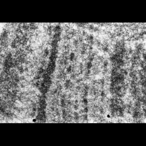  NCBI Organism:Drosophila melanogaster; Cell Components:polytene chromosome