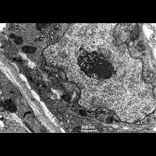  NCBI Organism:Maize mosaic virus, Peregrinus maidis, ; Cell Types:epithelial cell Cell Components:host cell perinuclear region of cytoplasm Biological process:viral transmission by vector, interspecies interaction between organisms;