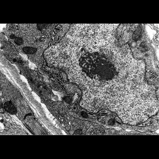  NCBI Organism:Maize mosaic virus, Peregrinus maidis, ; Cell Types:epithelial cell Cell Components:host cell perinuclear region of cytoplasm Biological process:viral transmission by vector, interspecies interaction between organisms;