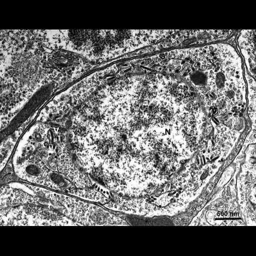  NCBI Organism:Maize mosaic virus, Peregrinus maidis, ; Cell Types:neuron associated cell Cell Components:nucleus, host cell perinuclear region of cytoplasm; Biological process:viral transmission by vector, interspecies interaction between organisms;