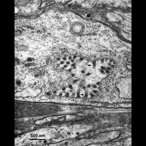  NCBI Organism:Maize mosaic virus, Peregrinus maidis, ; Cell Types:neuron Cell Components:axon, internal side of plasma membrane; Biological process:viral transmission by vector, interspecies interaction between organisms;