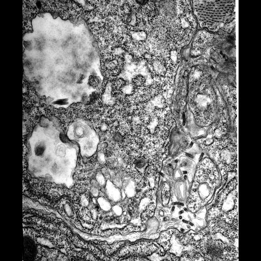  NCBI Organism:Maize mosaic virus, Peregrinus maidis, ; Cell Types:secretory cell Cell Components:vesicle Biological process:viral transmission by vector, interspecies interaction between organisms;