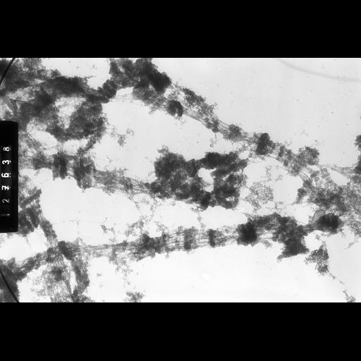  NCBI Organism:Drosophila melanogaster; Cell Components:polytene chromosome