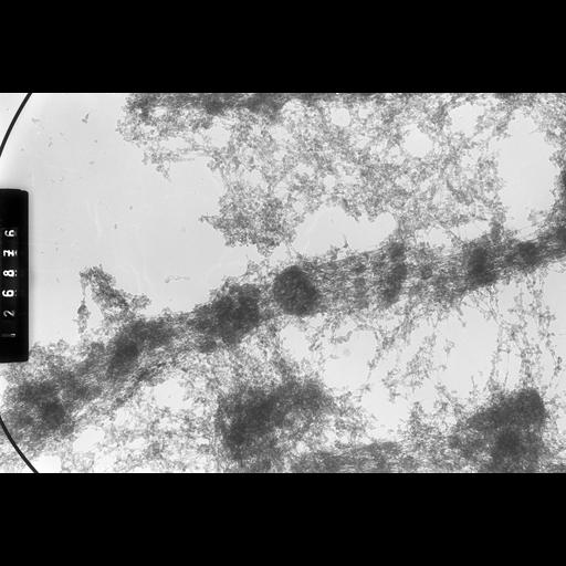  NCBI Organism:Drosophila melanogaster; Cell Types:fat body cell Cell Components:polytene chromosome