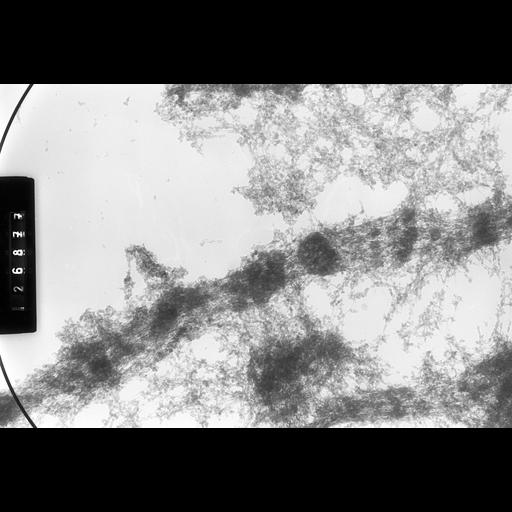  NCBI Organism:Drosophila melanogaster; Cell Types:fat body cell Cell Components:polytene chromosome