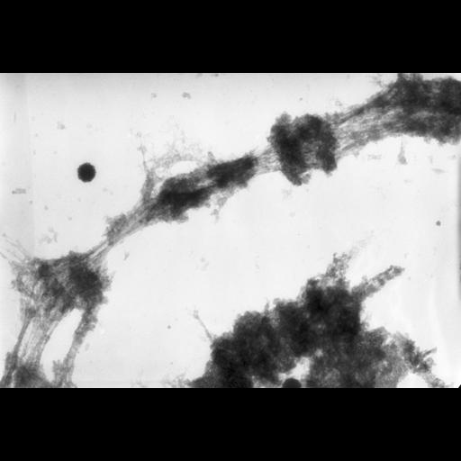  NCBI Organism:Drosophila melanogaster; Cell Components:polytene chromosome