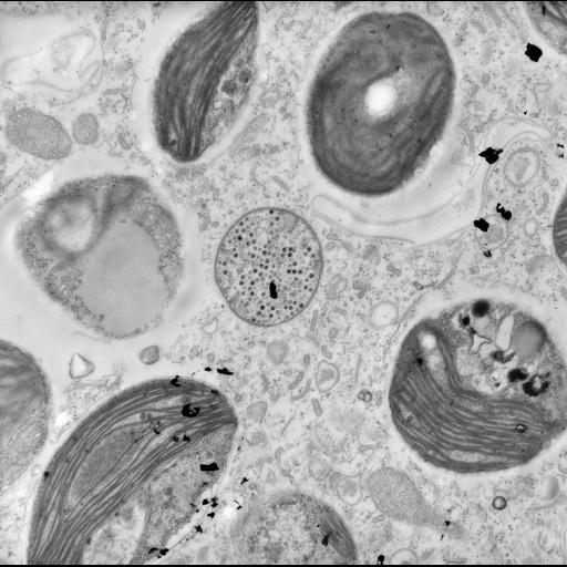  NCBI Organism:Trichodina, Chlorella, ; Cell Types:cell by organism, eukaryotic cell, , ; Cell Components:symbiont-containing vacuole, , cytoplasm, symbiont-containing vacuole, , virion, chloroplast thylakoid, chloroplast thylakoid membrane; Biological process:response to symbiont, oral apparatus organization, cytoplasm organization, , , , chloroplast organization;