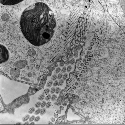  NCBI Organism:Trichodina, Chlorella, ; Cell Types:cell by organism, eukaryotic cell, , ; Cell Components:symbiont-containing vacuole, , oral apparatus, cortical cytoskeleton, cytoplasm, cilium axoneme; Biological process:response to symbiont, oral apparatus organization, cytoplasm organization, , ciliary or flagellar motility, cortical cytoskeleton organization;