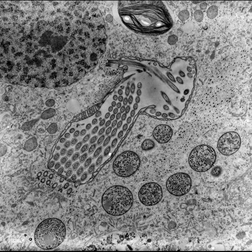  NCBI Organism:Trichodina, Chlorella, ; Cell Types:cell by organism, eukaryotic cell, , ; Cell Components:symbiont-containing vacuole, , , cytoplasm, oral apparatus, food vacuole, microtubule associated complex, , macronucleus; Biological process:response to symbiont, oral apparatus organization, cytoplasm organization, , , virion transport, macronucleus organization;