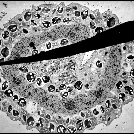  NCBI Organism:Trichodina, Chlorella, ; Cell Types:cell by organism, eukaryotic cell, , ; Cell Components:symbiont-containing vacuole, , oral apparatus, food vacuole, cytoplasm, macronucleus; Biological process:response to symbiont, oral apparatus organization, cytoplasm organization, , macronucleus organization;