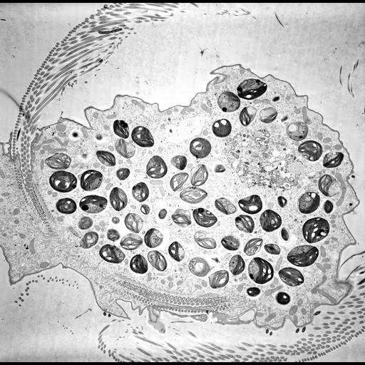  NCBI Organism:Trichodina, Chlorella, ; Cell Types:cell by organism, eukaryotic cell, , ; Cell Components:symbiont-containing vacuole, , oral apparatus, food vacuole, cytoplasm; Biological process:response to symbiont, oral apparatus organization, cytoplasm organization, ;