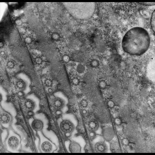  NCBI Organism:uncultured scuticociliate, , ; Cell Types:cell by organism, eukaryotic cell, , ; Cell Components:cell cortex, microtubule basal body, plasma membrane, cortical cytoskeleton, cortical microtubule cytoskeleton, mitochondrion, , cilium axoneme, coated pit; Biological process:cortical cytoskeleton organization, clathrin coat assembly, mitochondrion organization, microtubule basal body organization;