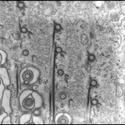  NCBI Organism:uncultured scuticociliate, , ; Cell Types:cell by organism, eukaryotic cell, , ; Cell Components:cell cortex, microtubule basal body, plasma membrane, cortical cytoskeleton, cortical microtubule cytoskeleton, mitochondrion, , cilium axoneme, coated pit; Biological process:cortical cytoskeleton organization, clathrin coat assembly, mitochondrion organization, microtubule basal body organization;