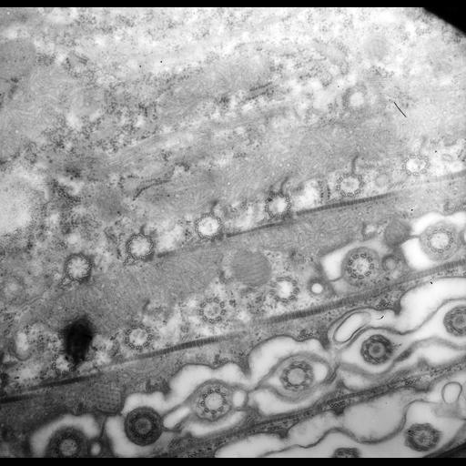  NCBI Organism:uncultured scuticociliate, , ; Cell Types:cell by organism, eukaryotic cell, , ; Cell Components:cell cortex, microtubule basal body, plasma membrane, cortical cytoskeleton, cortical microtubule cytoskeleton, mitochondrion, , cilium axoneme, coated pit; Biological process:cortical cytoskeleton organization, clathrin coat assembly, mitochondrion organization, microtubule basal body organization;