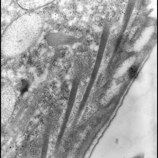  NCBI Organism:uncultured scuticociliate, , ; Cell Types:cell by organism, eukaryotic cell, , ; Cell Components:cell cortex, dense fibrillar component, microtubule, plasma membrane, cortical microtubule, ; Biological process:cortical cytoskeleton organization, fibril organization, microtubule cytoskeleton organization, cortical microtubule organization;