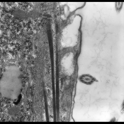  NCBI Organism:uncultured scuticociliate, , ; Cell Types:cell by organism, eukaryotic cell, , ; Cell Components:cell cortex, dense fibrillar component, microtubule, plasma membrane, cortical microtubule, ; Biological process:cortical cytoskeleton organization, fibril organization, microtubule cytoskeleton organization, cortical microtubule organization;