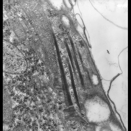  NCBI Organism:uncultured scuticociliate, , ; Cell Types:cell by organism, eukaryotic cell, , ; Cell Components:cell cortex, dense fibrillar component, microtubule, plasma membrane, cortical microtubule, ; Biological process:cortical cytoskeleton organization, fibril organization, microtubule cytoskeleton organization, cortical microtubule organization;