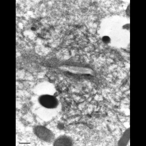  NCBI Organism:Paramecium multimicronucleatum; Cell Types:cell by organism, eukaryotic cell, , ; Cell Components:contractile vacuole, contractile vacuolar membrane; Biological process:contractile vacuole organization