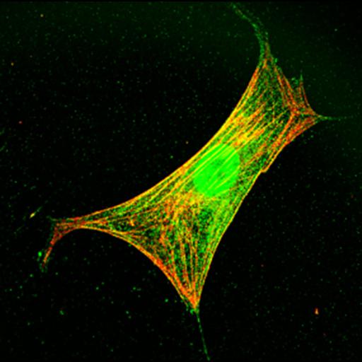  NCBI Organism:Mus musculus; Cell Types:fibroblast Cell Components:lamellipodium, myosin II complex, actin filament; Biological process:regulation of cell migration