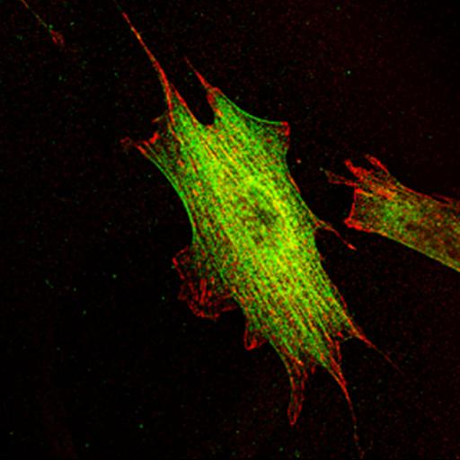  NCBI Organism:Mus musculus; Cell Types:fibroblast Cell Components:lamellipodium, myosin II complex, actin filament; Biological process:regulation of cell migration