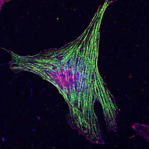  NCBI Organism:Mus musculus; Cell Types:fibroblast Cell Components:lamellipodium, myosin II complex, actin filament; Biological process:regulation of cell migration