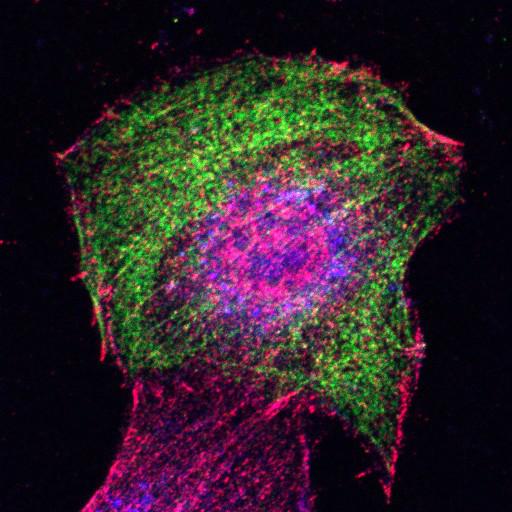  NCBI Organism:Mus musculus; Cell Types:fibroblast Cell Components:lamellipodium, myosin II complex, actin filament; Biological process:regulation of cell migration