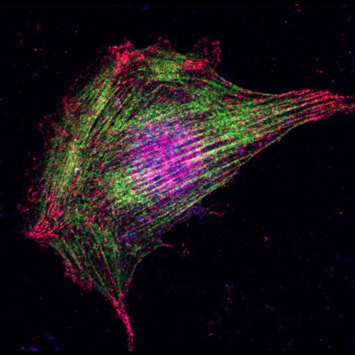  NCBI Organism:Mus musculus; Cell Types:fibroblast Cell Components:lamellipodium, myosin II complex, actin filament; Biological process:regulation of cell migration