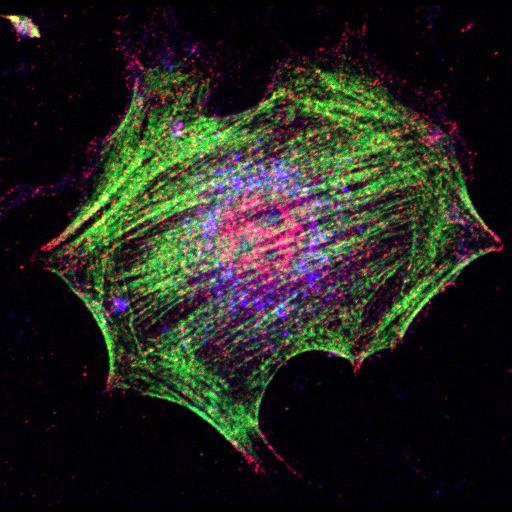  NCBI Organism:Mus musculus; Cell Types:fibroblast Cell Components:lamellipodium, myosin II complex, actin filament; Biological process:regulation of cell migration