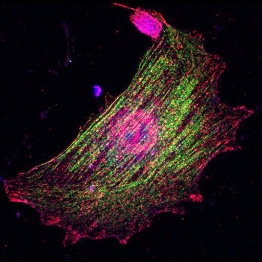  NCBI Organism:Mus musculus; Cell Types:fibroblast Cell Components:lamellipodium, myosin II complex, actin filament; Biological process:regulation of cell migration