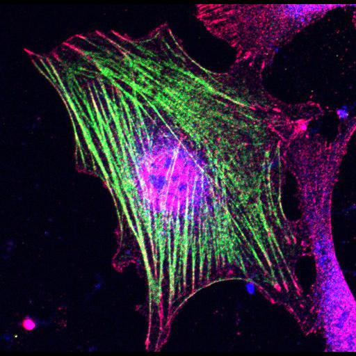  NCBI Organism:Mus musculus; Cell Types:fibroblast Cell Components:lamellipodium, myosin II complex, actin filament; Biological process:regulation of cell migration