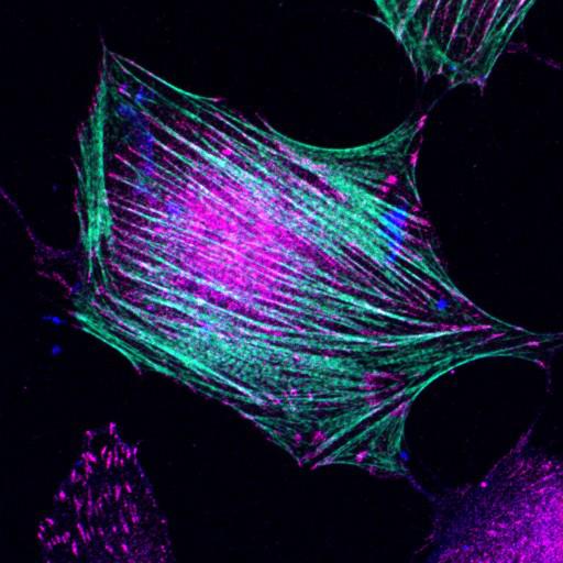  NCBI Organism:Mus musculus; Cell Types:fibroblast Cell Components:lamellipodium, myosin II complex, actin filament; Biological process:regulation of cell migration