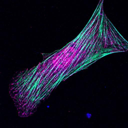  NCBI Organism:Mus musculus; Cell Types:fibroblast Cell Components:lamellipodium, myosin II complex, actin filament; Biological process:regulation of cell migration