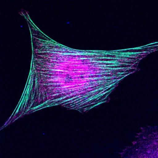  NCBI Organism:Mus musculus; Cell Types:fibroblast Cell Components:lamellipodium, myosin II complex, actin filament; Biological process:regulation of cell migration