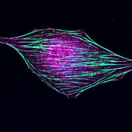  NCBI Organism:Mus musculus; Cell Types:fibroblast Cell Components:lamellipodium, myosin II complex, actin filament; Biological process:regulation of cell migration