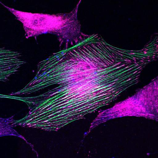  NCBI Organism:Mus musculus; Cell Types:fibroblast Cell Components:lamellipodium, myosin II complex, actin filament; Biological process:regulation of cell migration