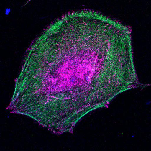  NCBI Organism:Mus musculus; Cell Types:fibroblast Cell Components:lamellipodium, myosin II complex, actin filament; Biological process:regulation of cell migration