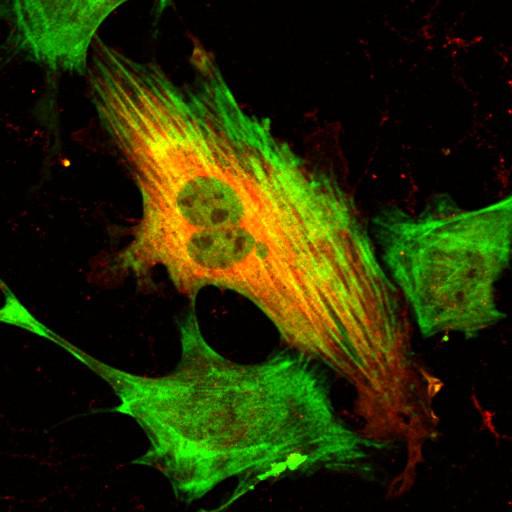  NCBI Organism:Mus musculus; Cell Types:fibroblast Cell Components:lamellipodium, myosin II complex, actin filament; Biological process:regulation of cell migration