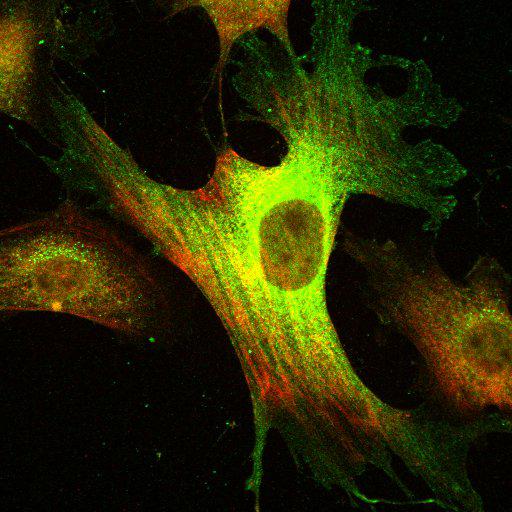  NCBI Organism:Mus musculus; Cell Types:fibroblast Cell Components:lamellipodium, myosin II complex, actin filament; Biological process:regulation of cell migration