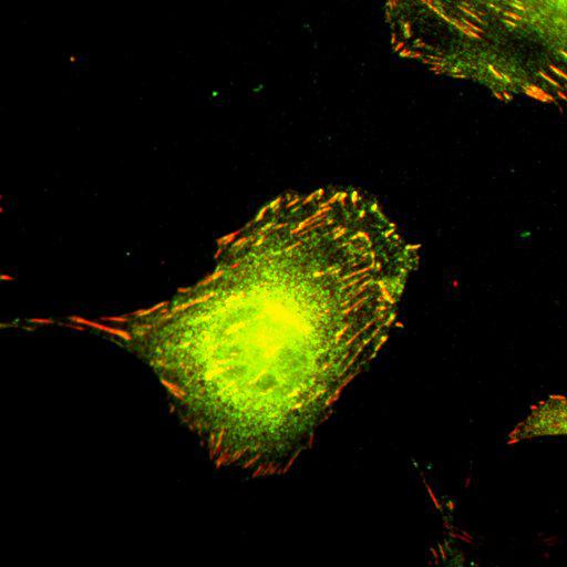  NCBI Organism:Mus musculus; Cell Types:fibroblast Cell Components:lamellipodium, myosin II complex, actin filament; Biological process:regulation of cell migration