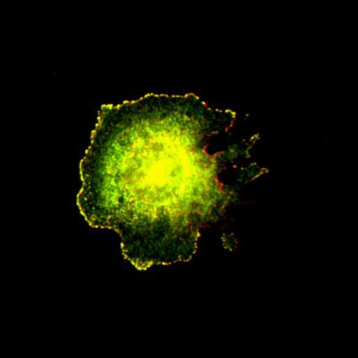  NCBI Organism:Mus musculus; Cell Types:fibroblast Cell Components:lamellipodium, myosin II complex, actin filament; Biological process:regulation of cell migration