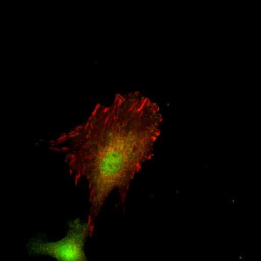  NCBI Organism:Mus musculus; Cell Types:fibroblast Cell Components:lamellipodium, myosin II complex, actin filament; Biological process:regulation of cell migration