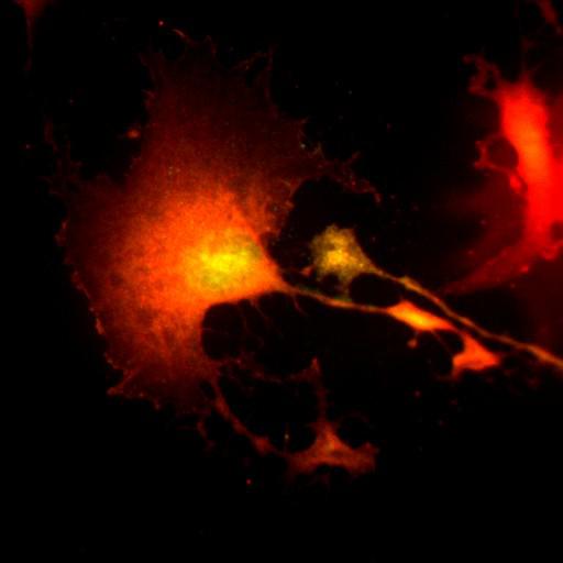  NCBI Organism:Mus musculus; Cell Types:fibroblast Cell Components:lamellipodium, myosin II complex, actin filament; Biological process:regulation of cell migration