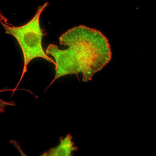  NCBI Organism:Mus musculus; Cell Types:fibroblast Cell Components:lamellipodium, myosin II complex, actin filament; Biological process:regulation of cell migration