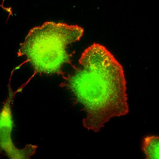  NCBI Organism:Mus musculus; Cell Types:fibroblast Cell Components:lamellipodium, myosin II complex, actin filament; Biological process:regulation of cell migration