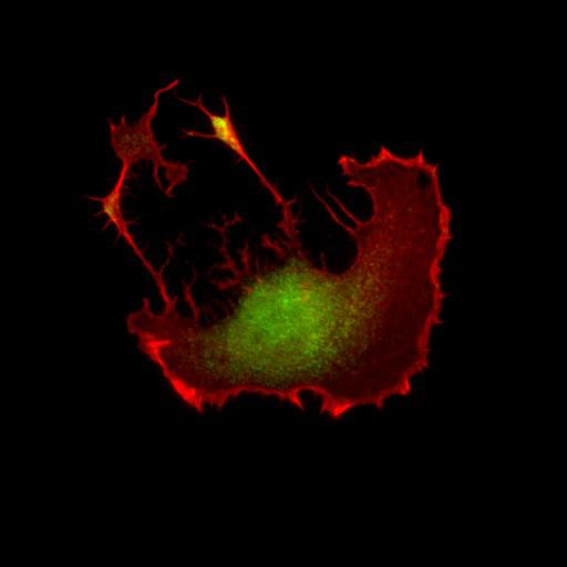  NCBI Organism:Mus musculus; Cell Types:fibroblast Cell Components:lamellipodium, myosin II complex, actin filament; Biological process:regulation of cell migration