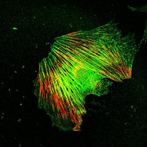  NCBI Organism:Mus musculus; Cell Types:fibroblast Cell Components:lamellipodium, myosin II complex, actin filament; Biological process:regulation of cell migration